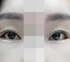 Mở đuôi mắt & mở góc mắt dưới ♥~