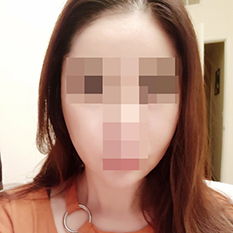 Thu gọn gò má quá tuyệt ㅎㅎ
