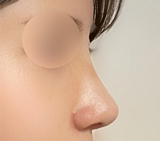 A nose I really love is complete~!