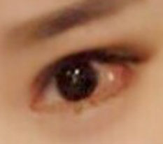 If you are debating eye surgery, just go for it