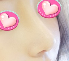 Tôi hạnh phúc vì hài lòng cả góc chính diện lẫn góc nghiêng hahaha