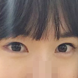 Cảm ơn bác sĩ Hwang-ho.