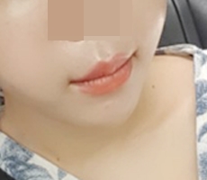 Mình làm khóe miệng vì đang có sự kiện :D