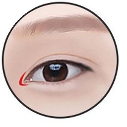 Mở góc mắt trong bước 2 — rạch nếp rẻ quạt