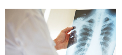 Kiểm tra X-Ray