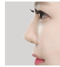 Ca mũi gồ nhìn nghiêng 2