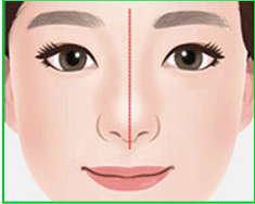 Minh họa dáng mũi bình thường